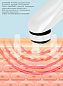 �������� ��� ���� 5�1 BeautyStar HIFU 3.0 (HIFU, RF, EMS, LED, ��) �����